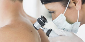 Cómo prevenir el cáncer de piel